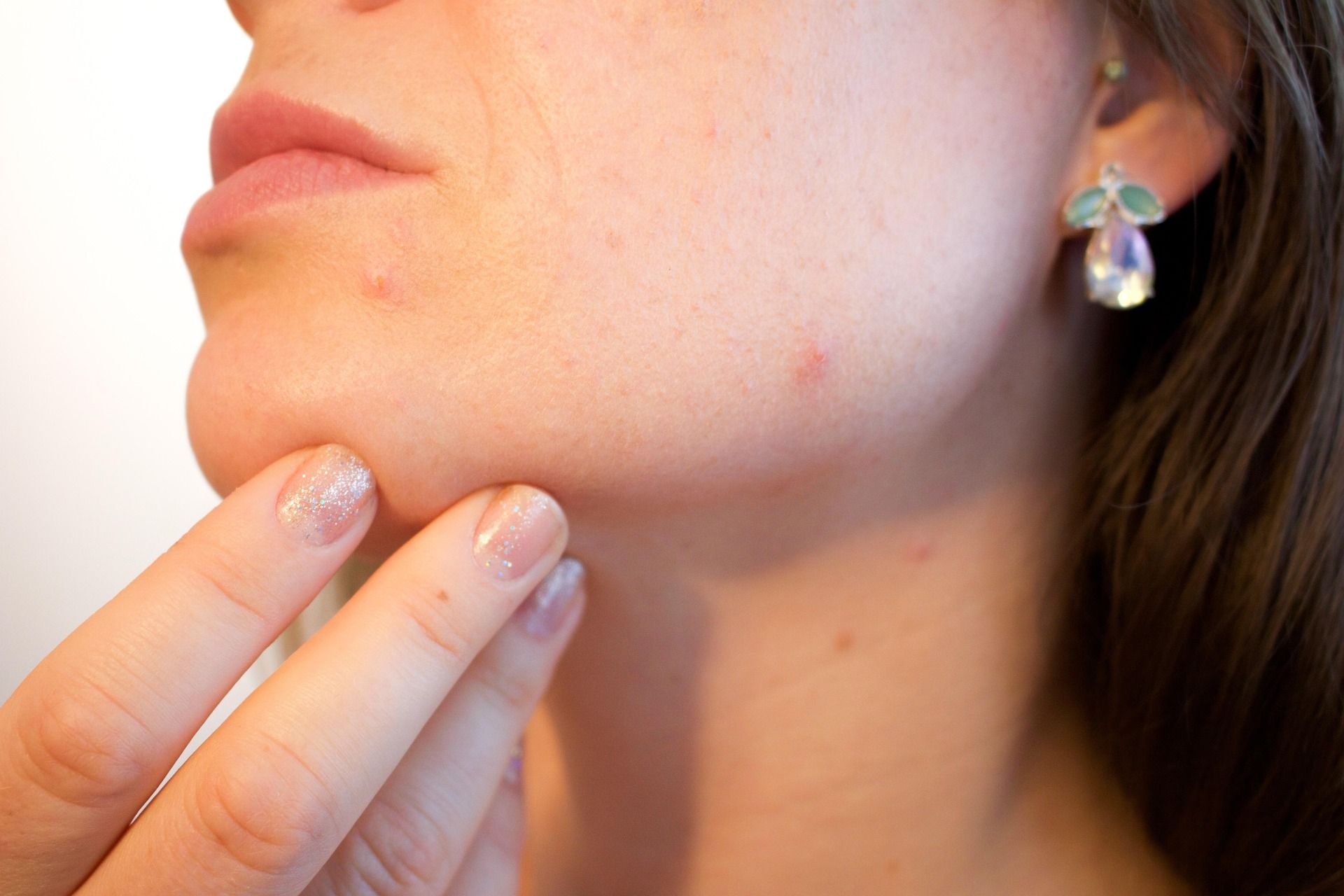 Kaip išsirinkti dermatologą Vilniuje ir pasiruošti pirmajai konsultacijai?