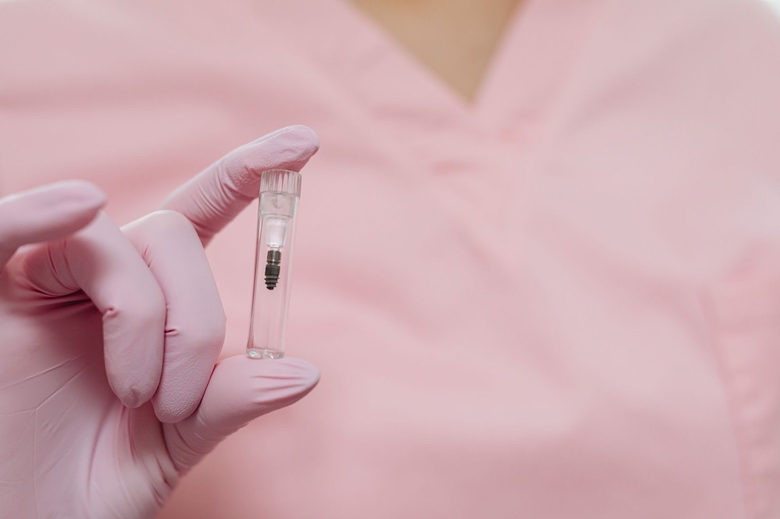 Dantų implantų kaina – nuo ko ji priklauso ir ką svarbu įvertinti?